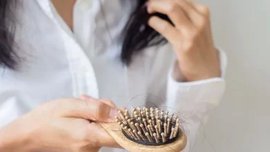 أسباب تساقط الشعر واهم العلاجات