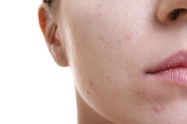 أنواع البشرة وكيفية معرفتها