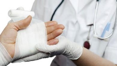 طرق فعالة في علاج الحروق في المنزل