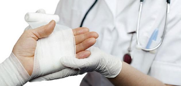 طرق فعالة في علاج الحروق في المنزل