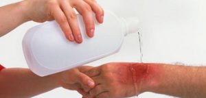 ما_هو_أفضل_علاج_للحروق