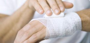 يعالج_الحروق