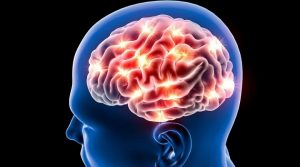 12 فكرة خاطئة عن السكتة الدماغية