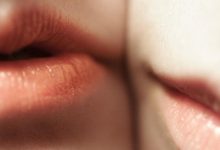 4 أمراض تنتقل بالتقبيل