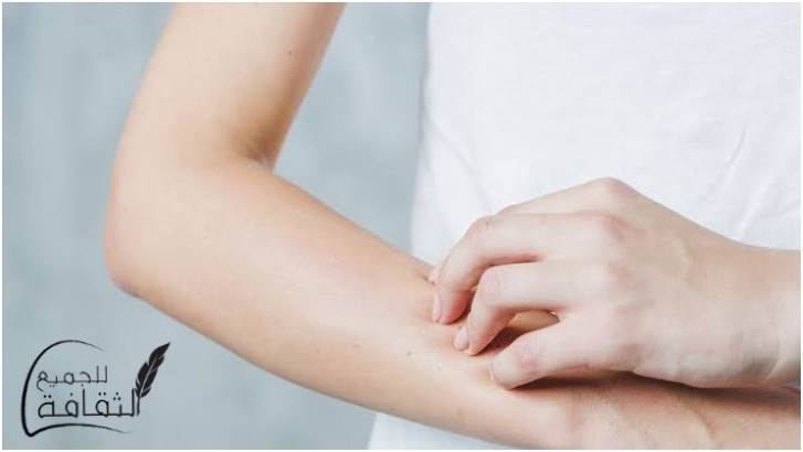 علاج الهرش الشديد والوقاية منه